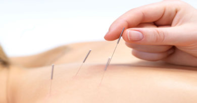 Acupuncture : comment bien coter Acupuncture : comment bien coter